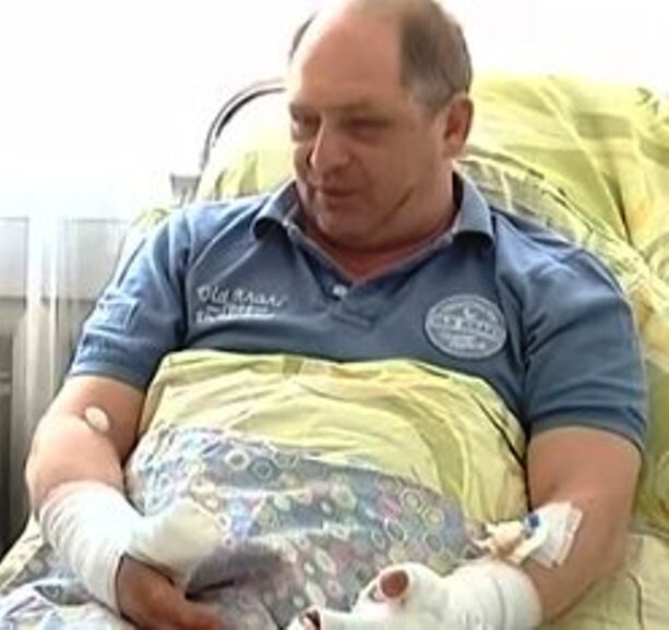 Ведущему детскому нейрохирургу Украины сломали руки - убирайся вон