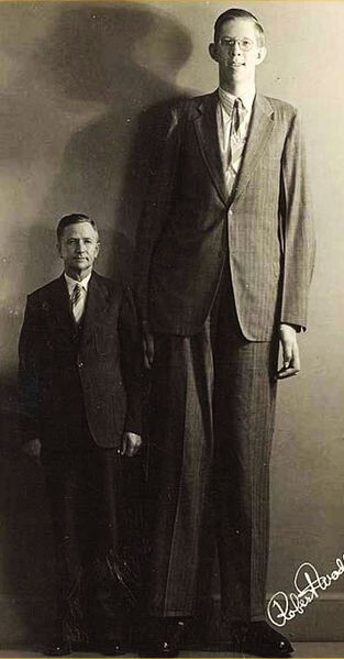 Роберт Уодлоу самый высокий человек в истории