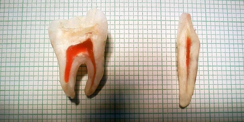 16. Человеческий зуб