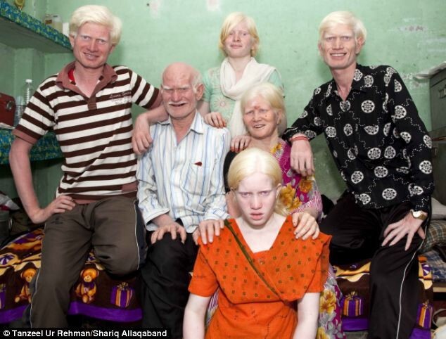 Альбинизм: не только среди белых