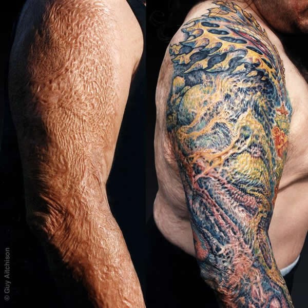 10 самых интересных татуировок, сделанных из-за шрамов и родимых пятен