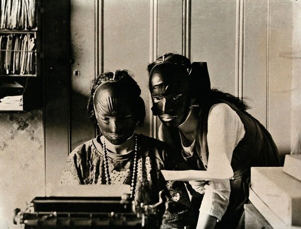 8. Резиновые маски "для красоты", использовавшиеся для избавления от морщин и возрастных пятен, 1921 г.