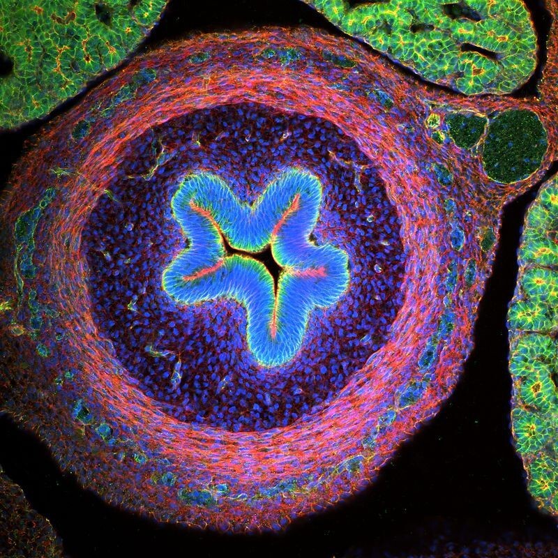 Ежегодный конкурс микрофотографии "Nikon Small World "