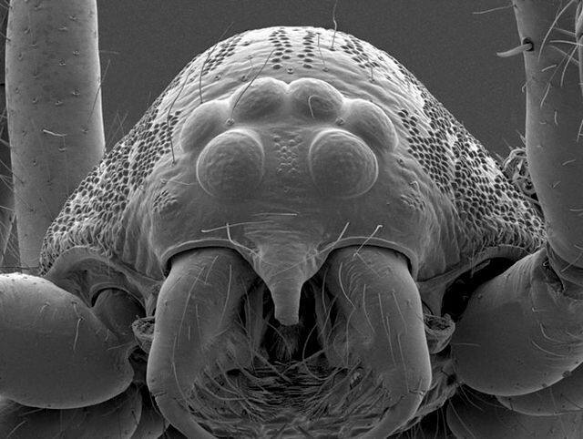 Снимок головы паука, полученный при помощи электронного микроскопа. Отлично видно шесть паучих глаз.