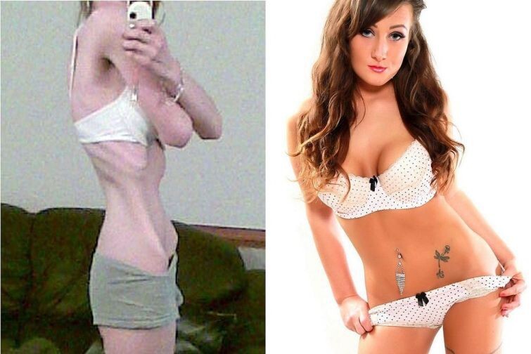 Девушка, которая едва не умерла от анорексии, поверила в себя и стала моделью