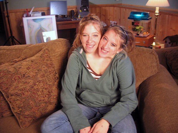 7. Сросшиеся близнецы – Эбигейл и Бриттани Хенсел, 1990 года рождения, проживающие в США.