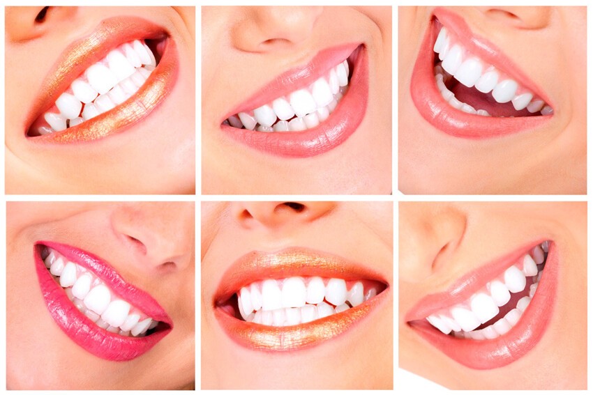 4. Повышение здоровья зубов