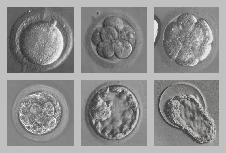 Эмбрионы в мышином глазу