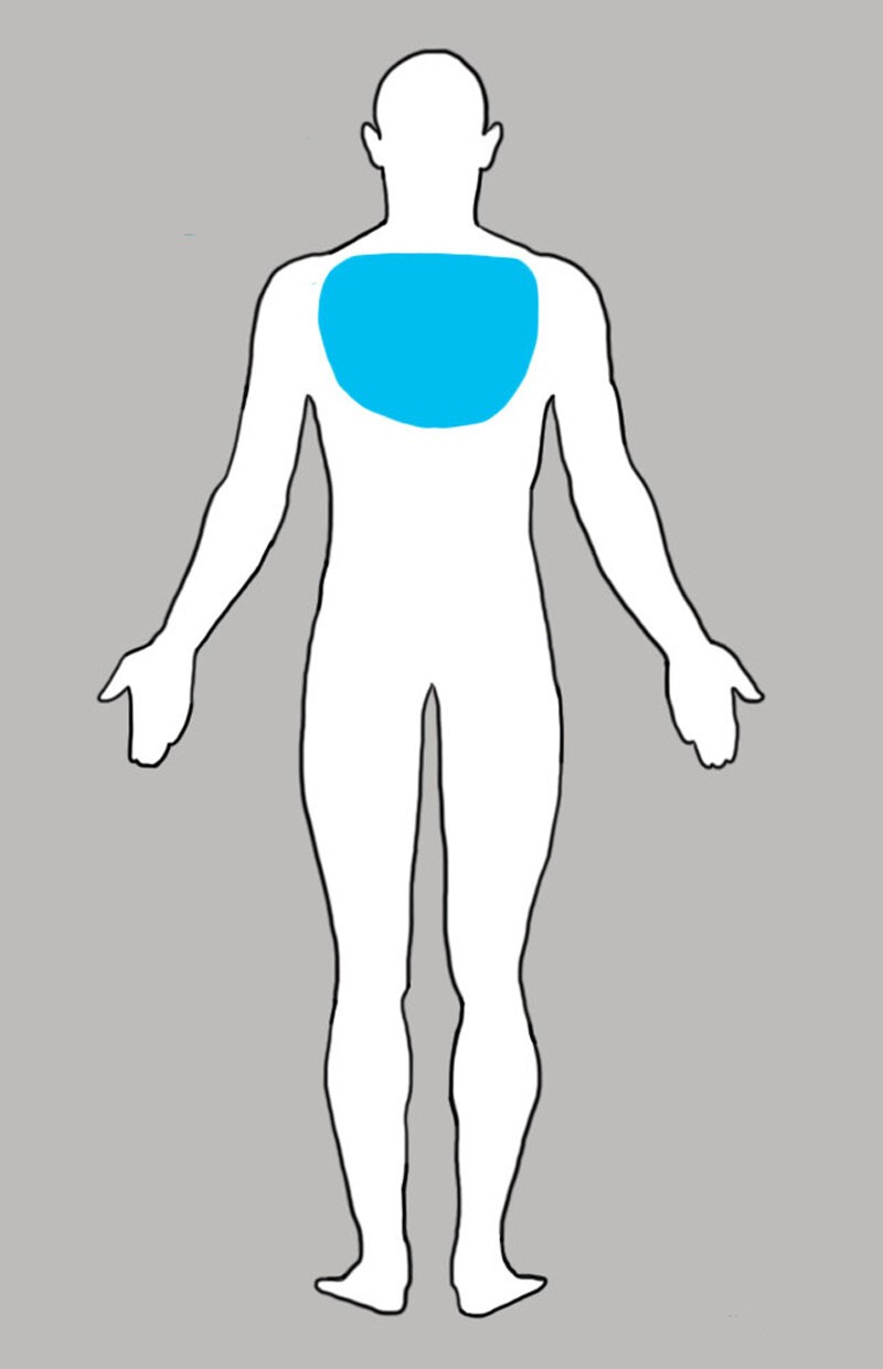 4. Боль в верхнем отделе спины