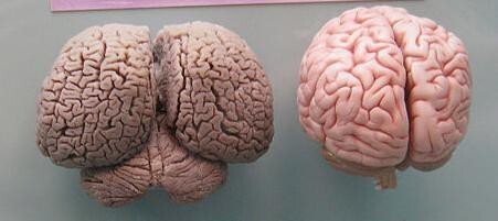 11. Человеческий мозг справа, мозг дельфина слева. Невероятно, правда?