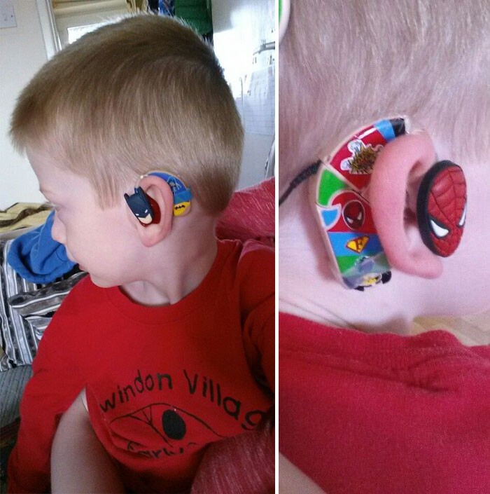 "Да, детям не нравится носить слуховые аппараты, но они могут изменить своё отношение к ним, если превратить это в игру", - говорит Айверми.