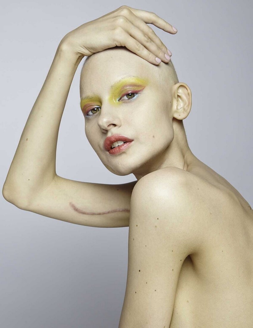 Невероятные фотографии модели, потерявшей челюсть из-за рака  