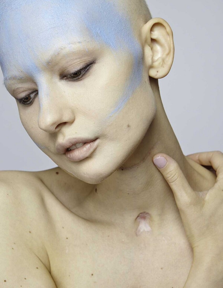 Невероятные фотографии модели, потерявшей челюсть из-за рака  