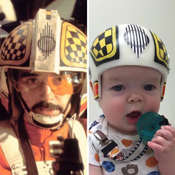 Папа украсил ортопедические шлемы сына иконографией "Звездных войн"