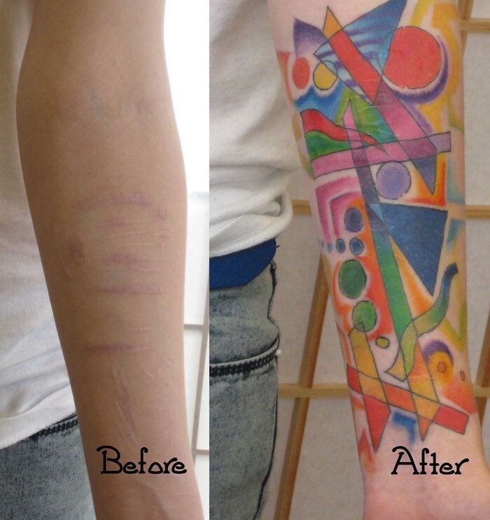 Оригинальные тату, которые помогли  замаскировать шрамы и прочие дефекты кожи