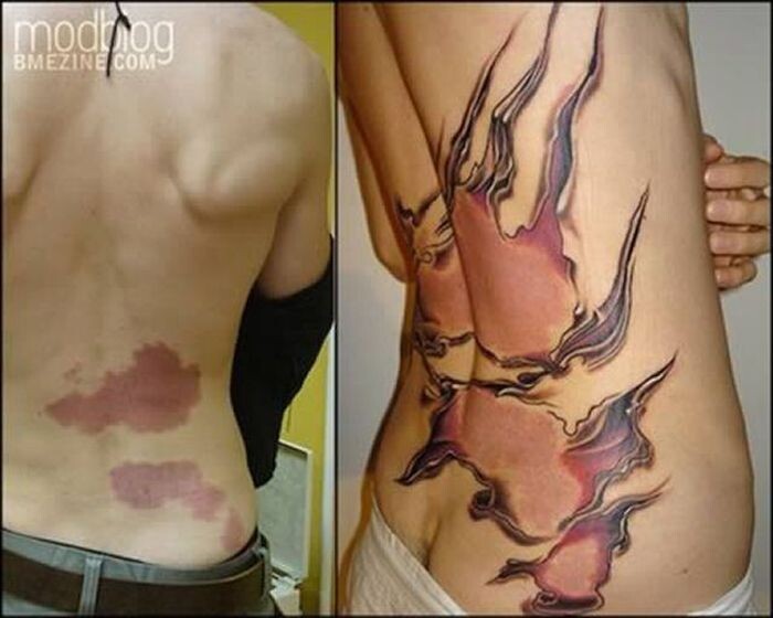 Оригинальные тату, которые помогли  замаскировать шрамы и прочие дефекты кожи