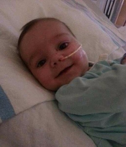 18. Малыш улыбается после третьей операции в пять месяцев