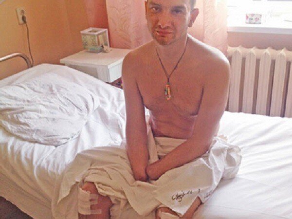 Солдата ВСУ без рук и ног отказались признавать инвалидом