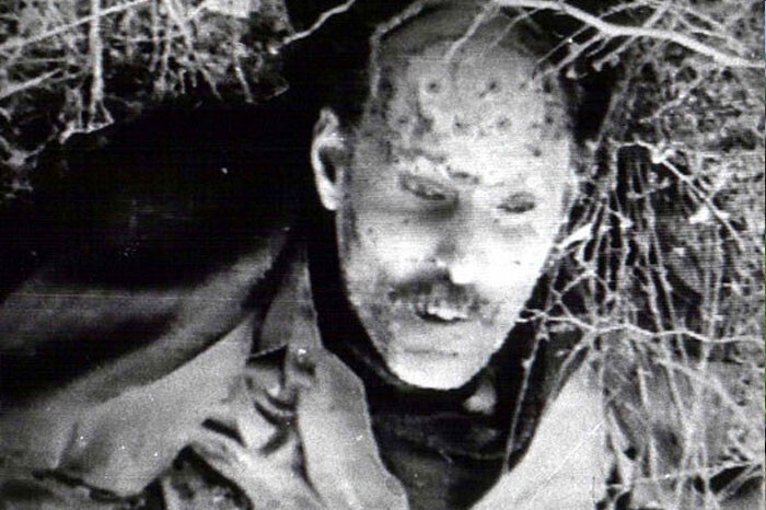 Фото № 15. Скальпированный череп.