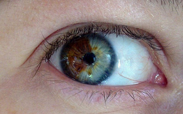 Как люди меняют цвет глаз