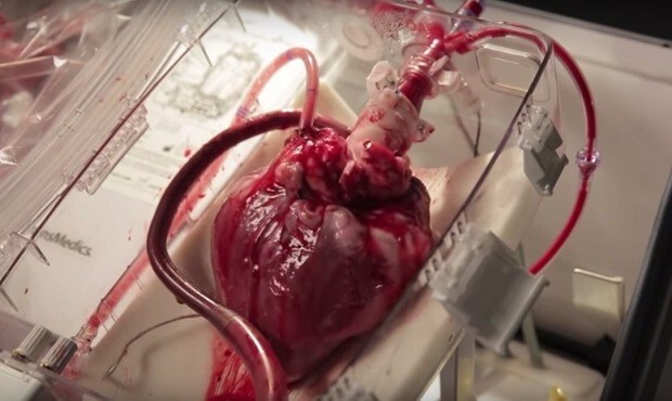 Изобретен аппарат, заставляющий сердце биться без тела