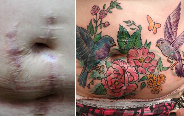 Татуировка на животе скрыла ужасные шрамы от ножевых ранений