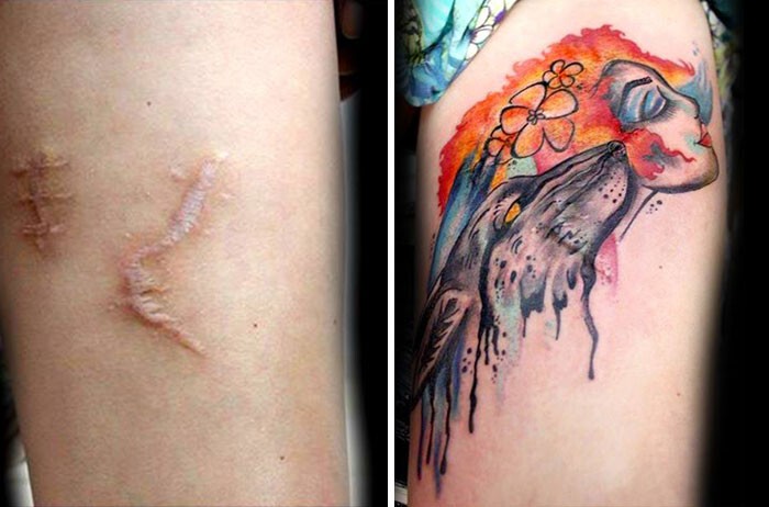 Шрамы от физического насилия на теле 17-летней девушки, скрытые под татуировкой