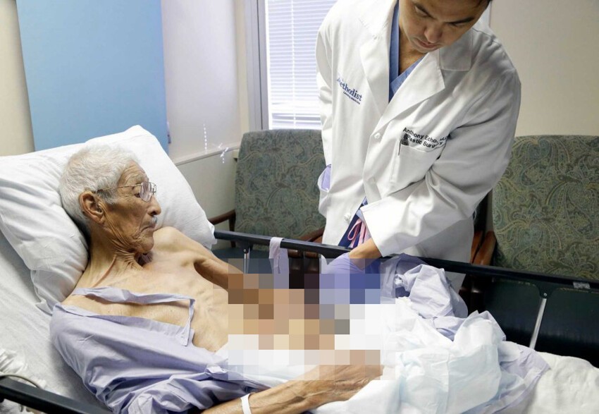 Чтобы спасти руку мужчины, врачи пришили ее к животу