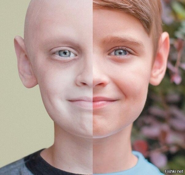 Мальчик, который победил рак