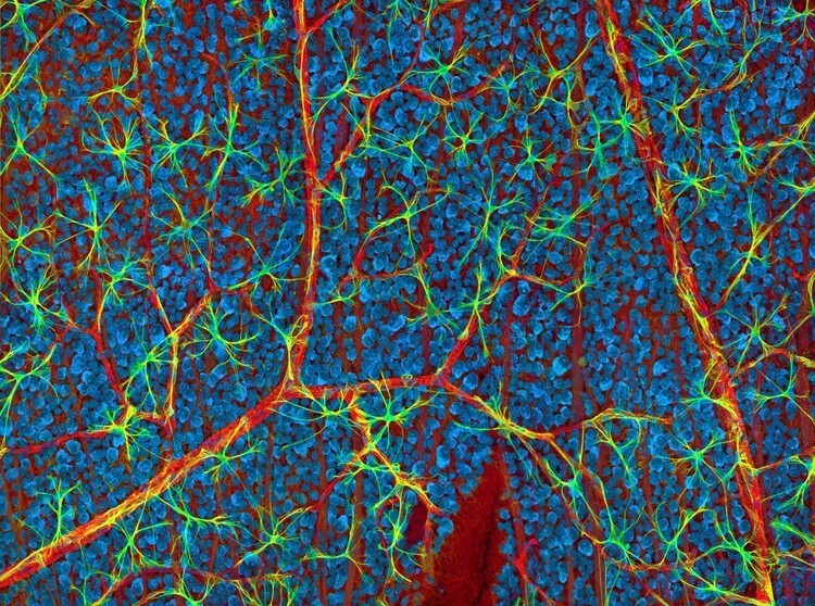 11. Кровеносные сосуды и нервные клетки в сетчатке мыши