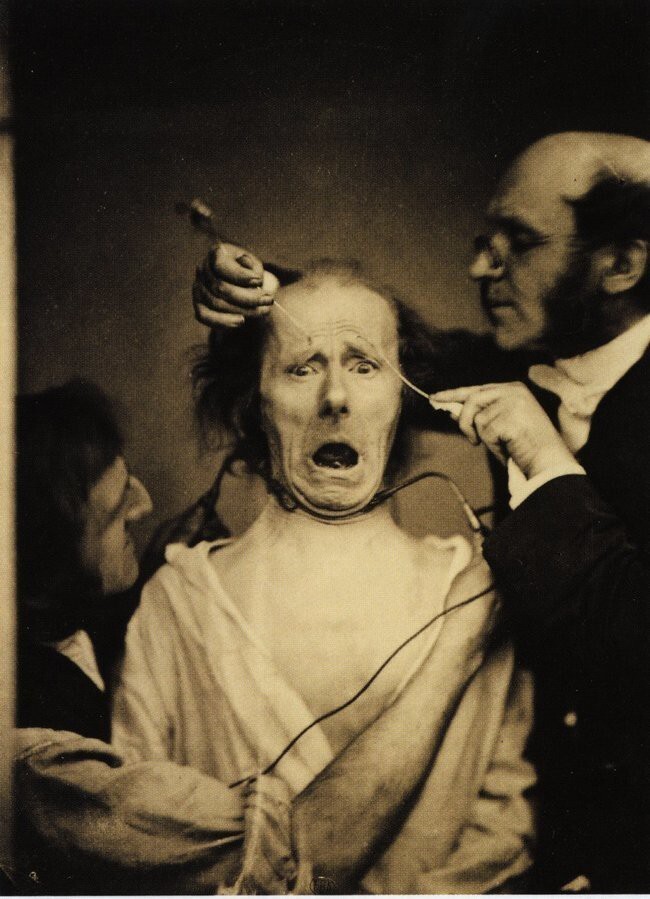 3. Невролог Дюшен де Булон применяет электрические разряды с целью изучения мышц лица, Франция, 1862.