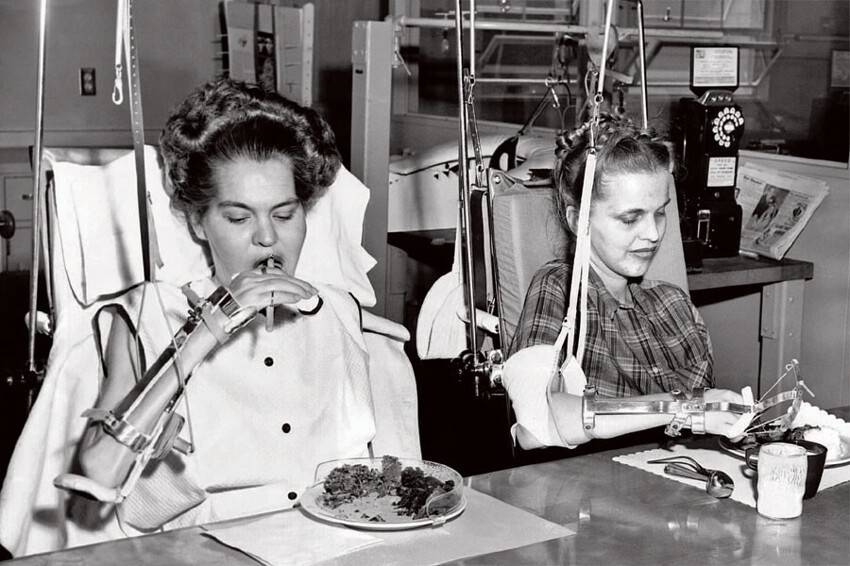 6. Две девушки проходят реабилитацию после полиомиелита. 1954 год.