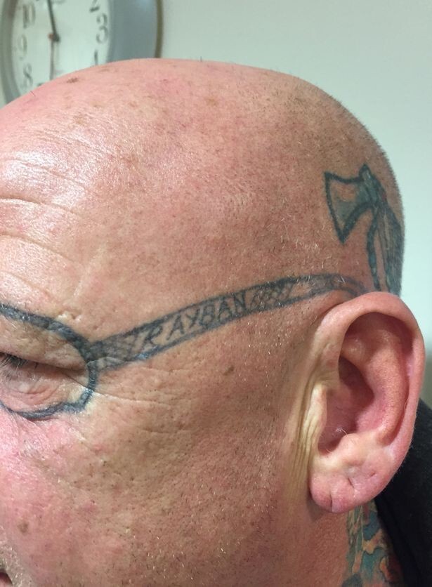 Пожилой британец 2 года удалял очки-тату, которые ему «набили», пока он спал пьяный