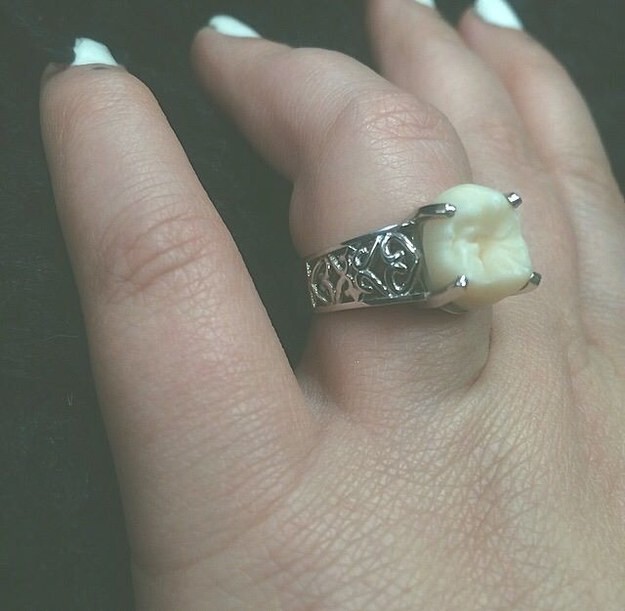 Американец сделал предложение своей девушке, подарив кольцо с зубом