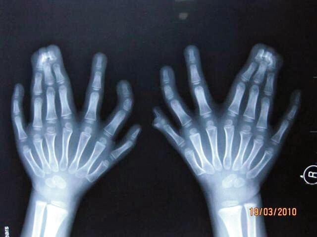 5 одних из самых интересных рентгеновских снимков за всю историю