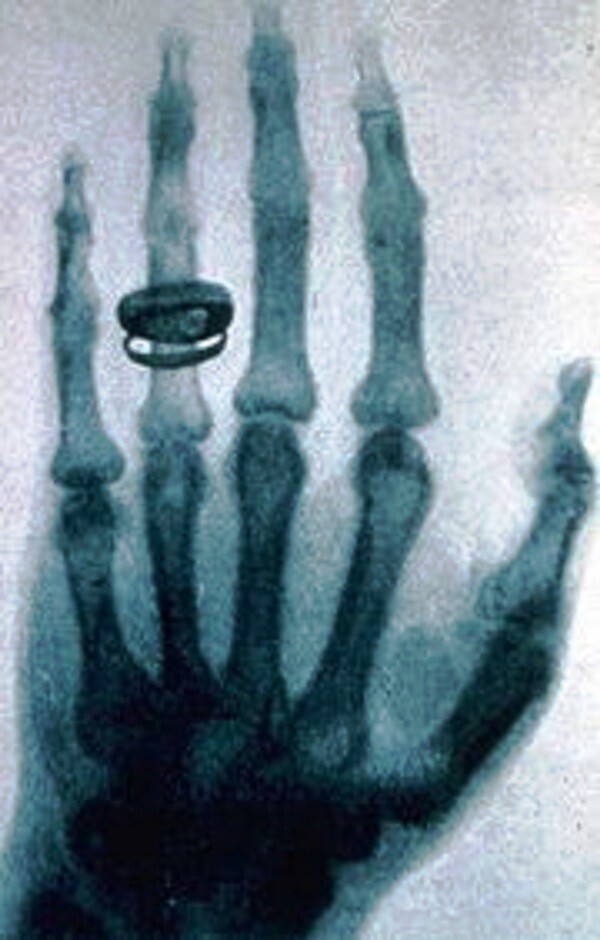 5 одних из самых интересных рентгеновских снимков за всю историю
