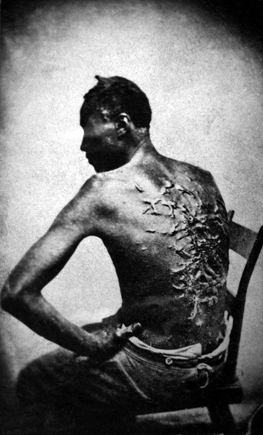 21. Бывший раб показывает свои шрамы от битья, штат Луизиана США, 1863 г.