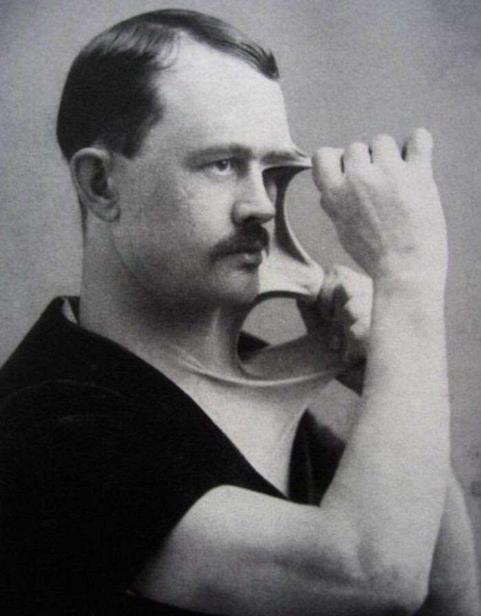 Мужчина с эластичной кожей. 1900-е