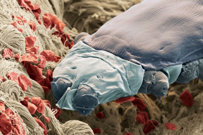 17. У большинства людей в ресницах живут микроскопические клещи демодекс, у которых есть когти и рот.