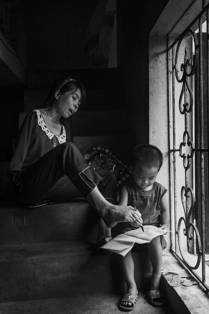 После войны: Вьетнамка, родившаяся без рук, живет нормальной жизнью и заботится о племяннике 
