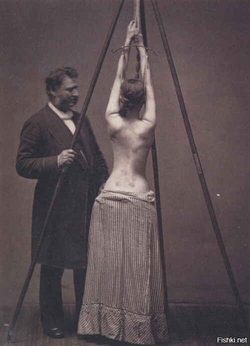 Лечение сколиоза, 1870–е, США