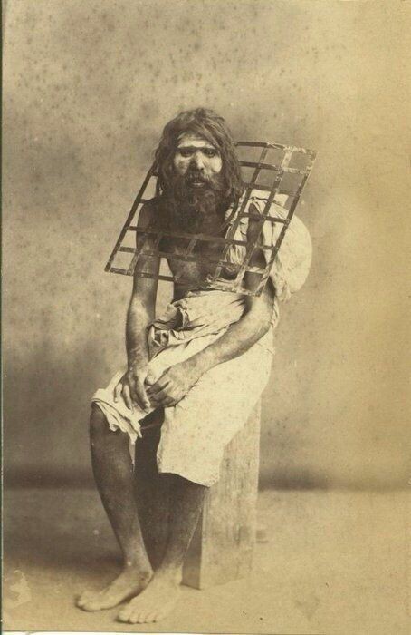 Подвижник с металлической решеткой на шее одетой так, что он не может лечь, 1900-е  Подвижник - тот, кто изнуряет себя лишениями, постом, молитвами во имя служения Богу