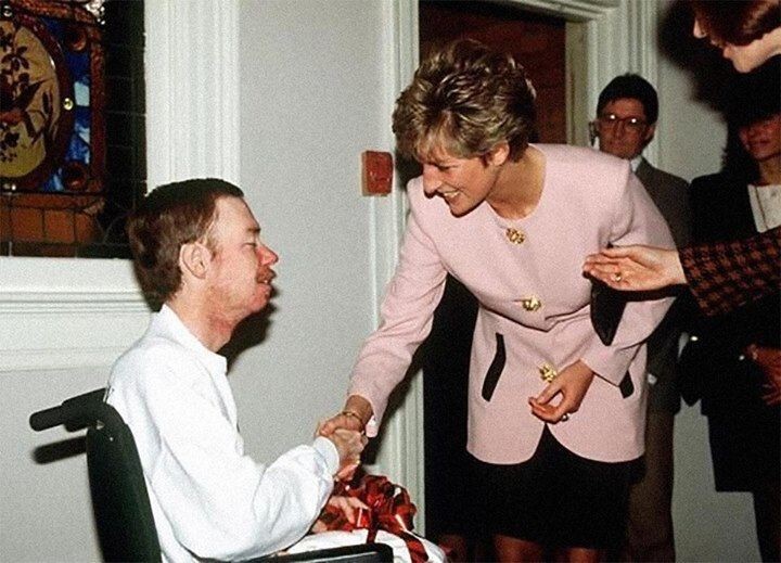 Принцесса Диана пожимает руку больного СПИДом без перчаток. Широкий жест в то время. 1991 год.