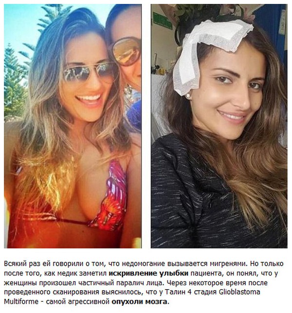 Как улыбка спасла жизнь 30-летней бразильянке