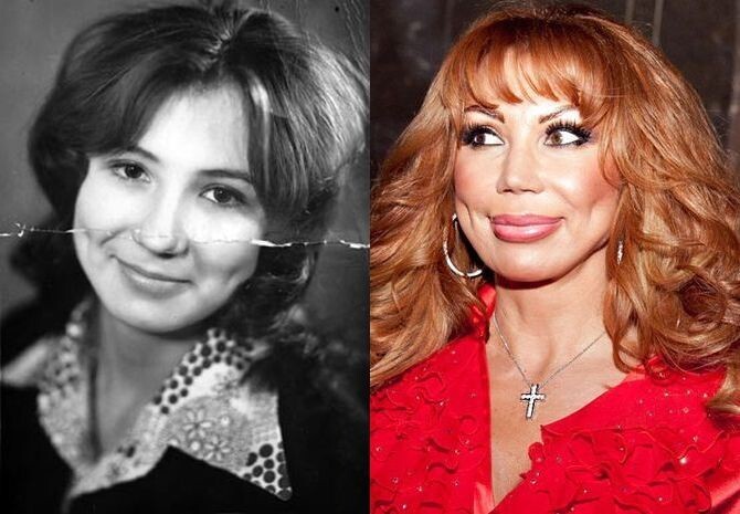 Артисты до и после пластики