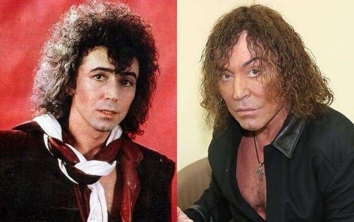 Артисты до и после пластики