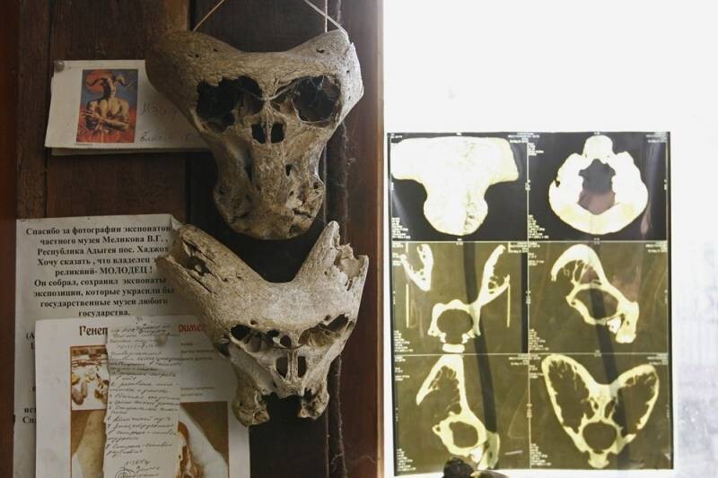 Чемоданчик Аненербе в Адыгее и странные черепа