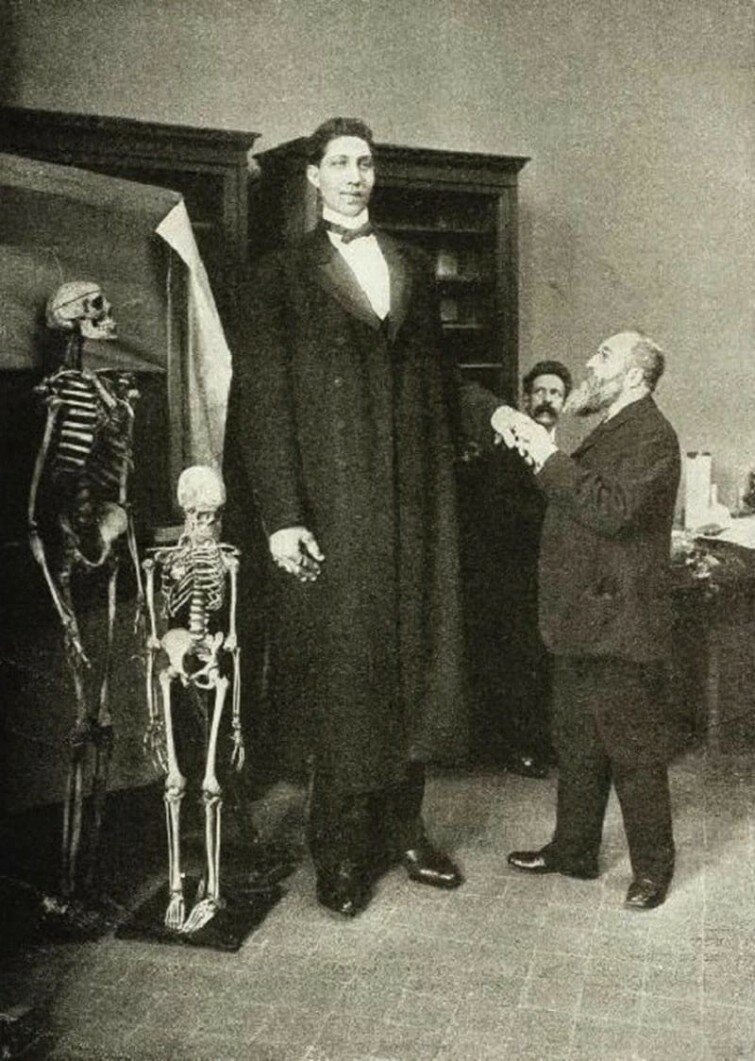 Федор Махнов, его рост был 285 сантиметров при весе около 182 кг, 1900-е.  