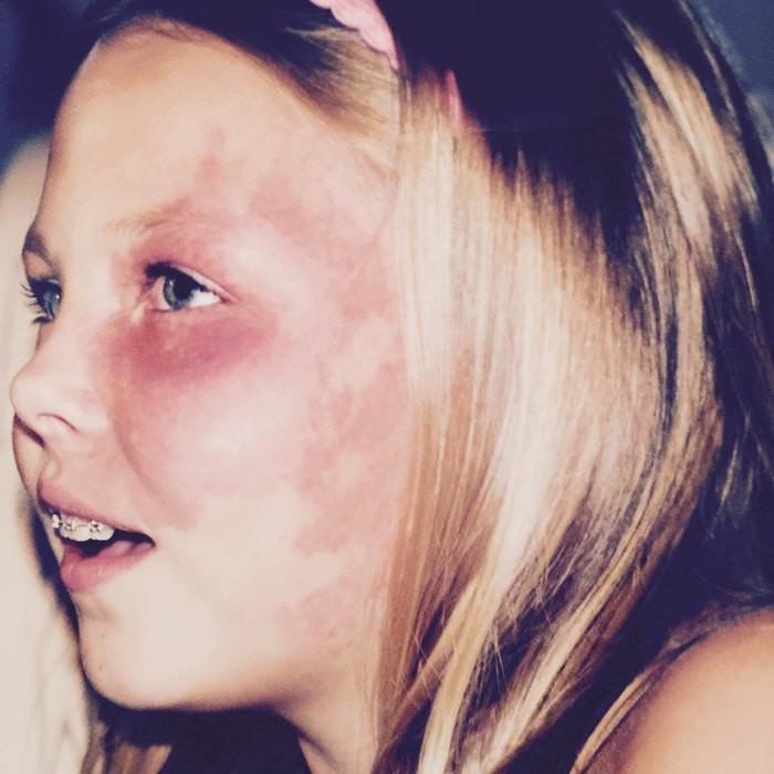 Девушка с родимым пятном на лице стала звездой и помогает людям поверить в себя