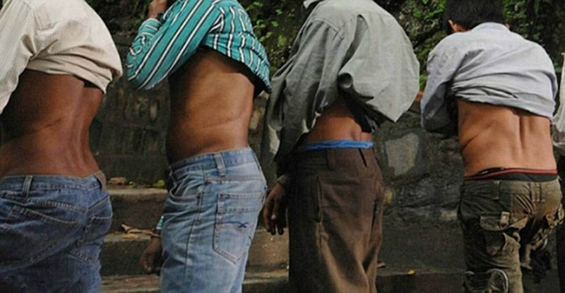Мужчины деревни Хоксе в Непале демонстрируют шрамы от операции после удалении почек. 